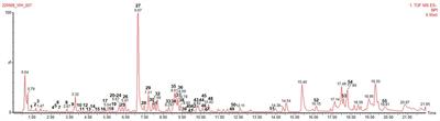 Phytochemical profile and anti-inflammatory activity of the hull of γ-irradiated wheat mutant lines (Triticum aestivum L.)